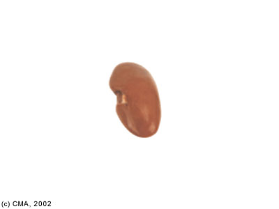 ������� (��������)
